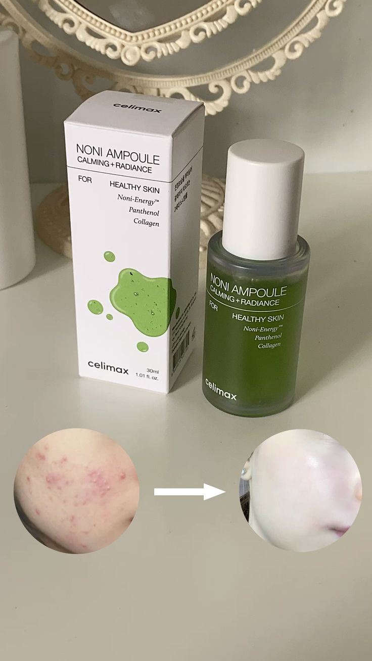 CELIMAX THE REAL NONI ENERGY AMPOULE 30 ML