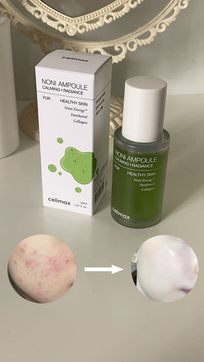 CELIMAX THE REAL NONI ENERGY AMPOULE 30 ML